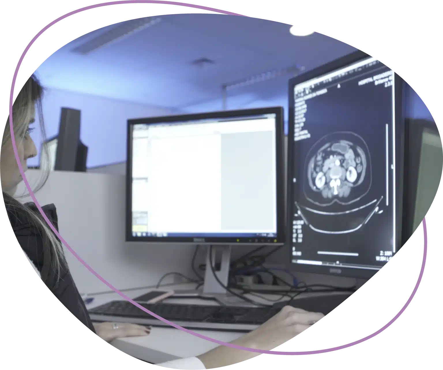 telerradiologia